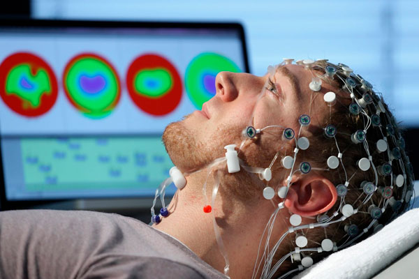 Eletroencefalograma digital 24 canais